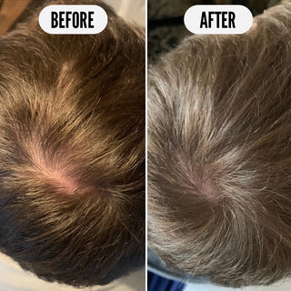 Klaar voor Groei Groeitonic - 75ml